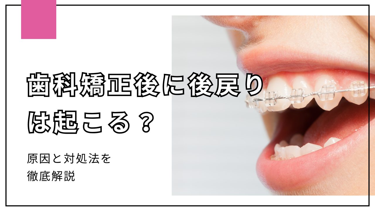 歯科矯正後に後戻りは起こる?原因と対策を徹底解説 - 名古屋市昭和区の歯医者・小児歯科・矯正歯科|あんどう歯科・美容皮フ科